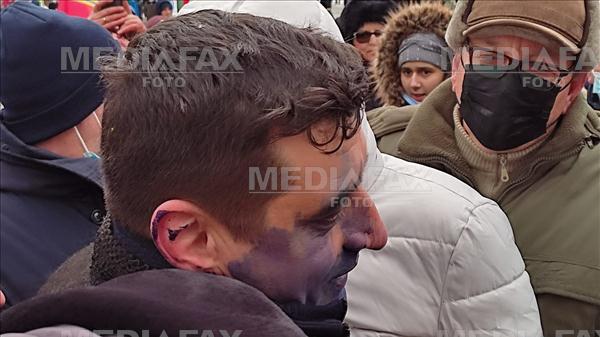 Liderul Aliantei pentru Unirea Romanilor, George Simion, a fost stropit cu cerneala in timpul unui miting organizat pentru sarbatorirea Unirii Principatelor Rom... Foto: Ziarul de Iasi.